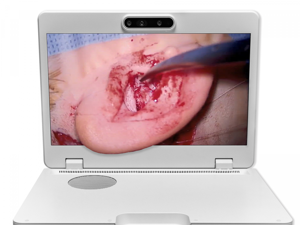 達擎之＂Heads-up 3D顯微手術(shù)顯示系統(tǒng)＂，整合4K裸眼3D顯示及眼球追蹤系統(tǒng)，具備快速追蹤人眼移動位置功能，減輕醫(yī)師長時間維持固定姿勢的負擔(dān)，讓醫(yī)師能有更寬廣清晰的3D立體視野及更舒適的姿勢來執(zhí)行手術(shù)。